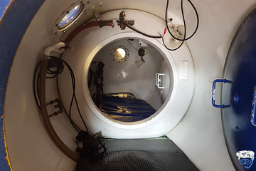 What is the most common manifestation of decompression sickness