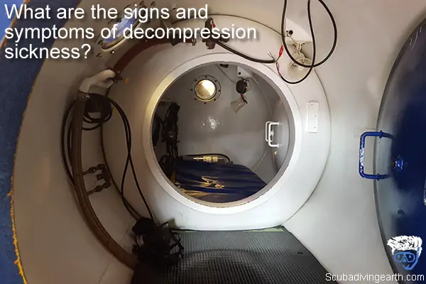What are the signs and symptoms of decompression sickness